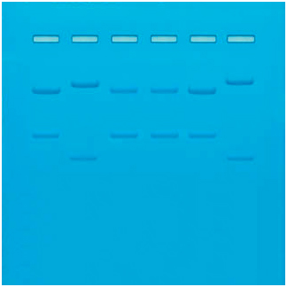 PCR 유전자 지문 분석 실험 / 제한효소 패턴에 의한 DNA 지문분석